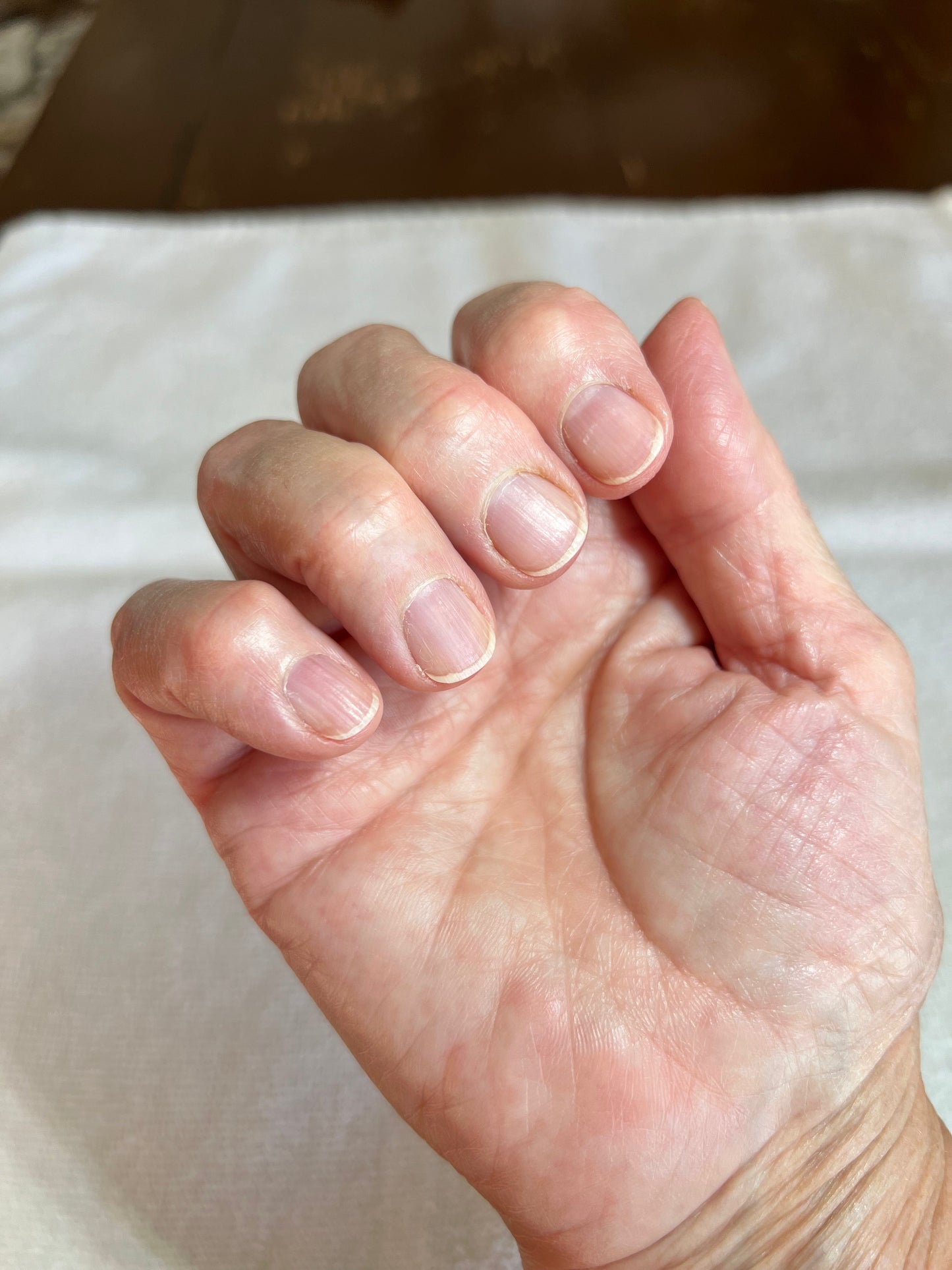 Anna's Professional Nail Assessment
