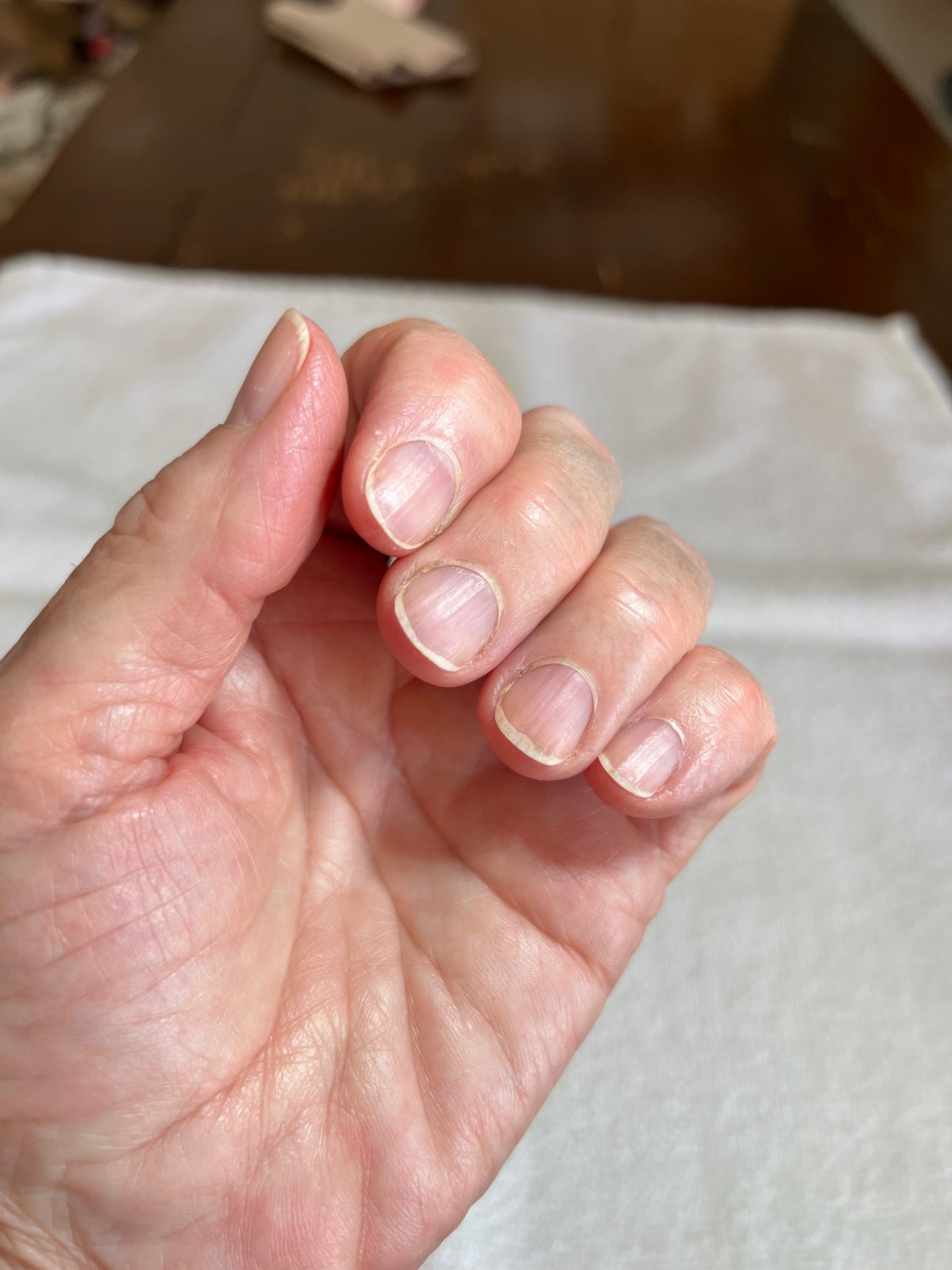 Anna's Professional Nail Assessment