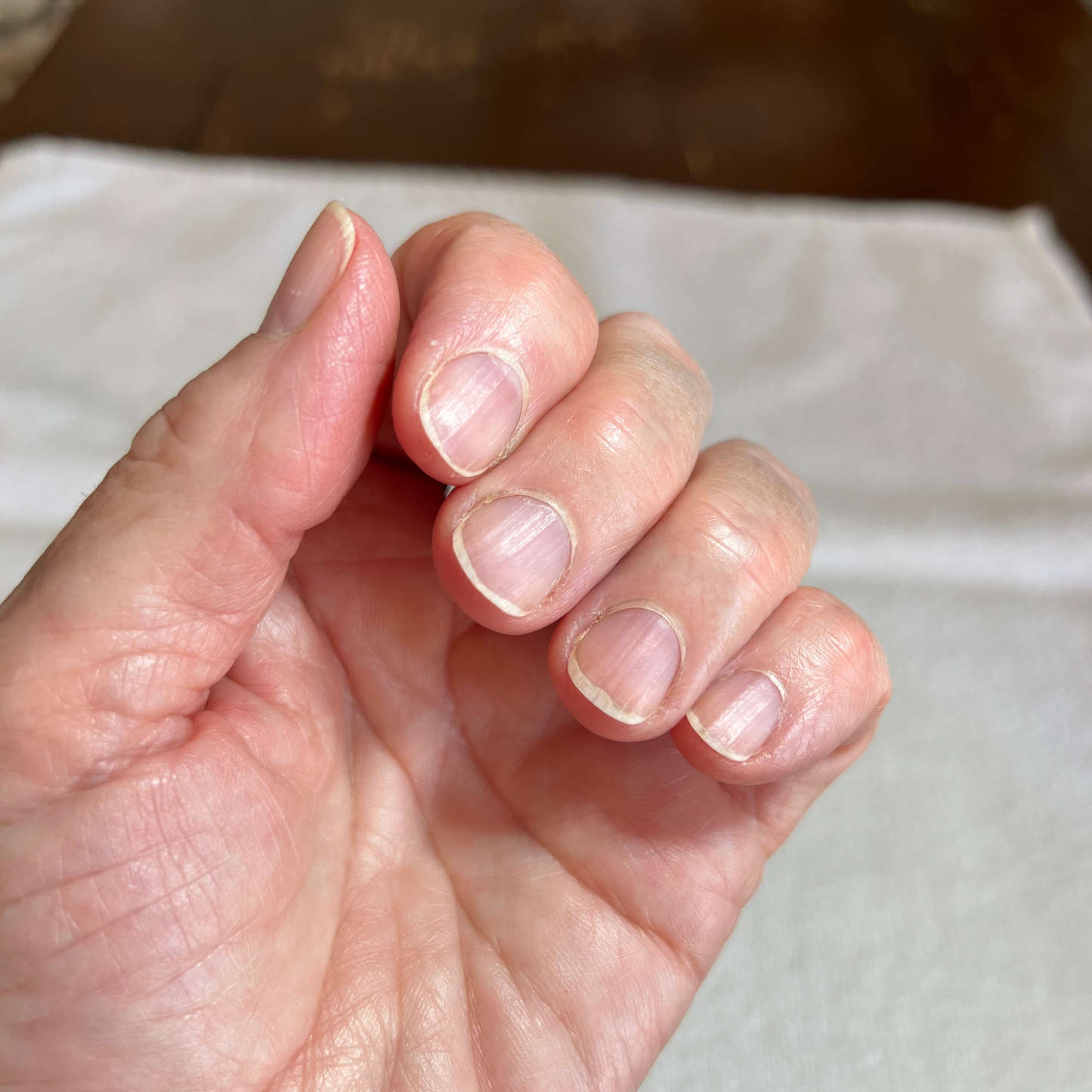 Anna's Professional Nail Assessment